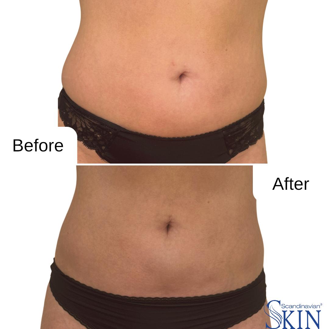 instories_98FFA47E-8ABA-4EA4-B2A4-3BA1DC95A730