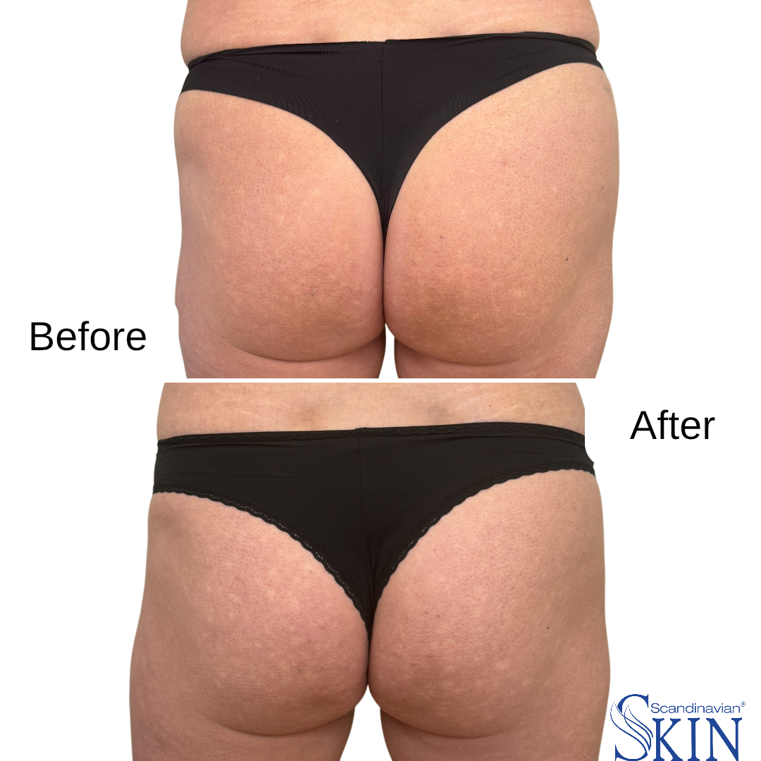 instories_BF603B2B-77AD-4DEE-9832-606AB4E53219